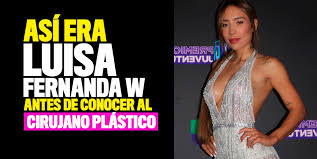 Antes de entrar a la fama y ser tan reconocida 'la segura' era más robusta, tenía un poco más de abdomen y poco busto, hasta los seguidores quedan sorprendidos con el radical cambio. Asi Era Luisa Fernanda W Antes De Conocer Al Cirujano Plastico Q Hubo Cali