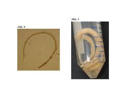 Der stuhl sollte in eine frisch gespülte, mit papier getrocknete und ausgelegte toilettenschüssel oder in. Nachweis Intestinaler Wurmer Mittels Koproskopischer Untersuchungen