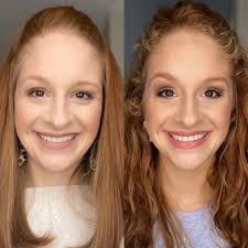 Meet Tonya—she's been using our Transformation Set for just 30 days, and  the results speak for themselves. NO filters. Just REAL, transformative  results backed by our 60-day money-back guarantee. 🙌 ✨ Here's