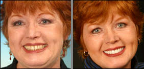 Dr. Gary Thiele, Cosmetic Dentist Turlock, Cosmetic Dentist Merced,  Cosmetic Dentist Stockton, Cosmetic Dentist Modesto