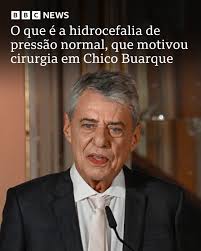 Chico Buarque foi submetido a uma cirurgia para tratar quadro de  hidrocefalia de pressão normal Condição é marcada pelo acúmulo de líquidos  no cérebro e pode gerar sintomas parecidos aos da demência,