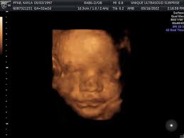 This Lil 8.2lb baby is feeling better this morning...and says hello..