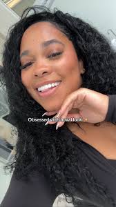 Buck Teeth Transformation Veneers