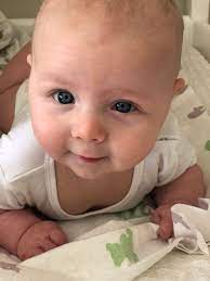 2 week old baby bags under eyes. Baby Has Bags Under Eyes Pics Included August 2019 Babies Forums What To Expect Page 2