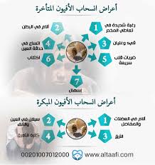 التوتر والدورة الشهرية 7 خطوات تساعدك على التخلص منه بسهولة map