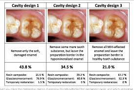 Its head is barely elongated, presented with a huge clock above its eyes and nose. Treatment Decisions On Molar Incisor Hypomineralization Mih By Norwegian Dentists A Questionnaire Study Semantic Scholar