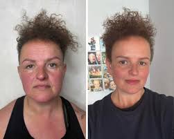 Timperley Wedge consultation is now open. Closes start of September.