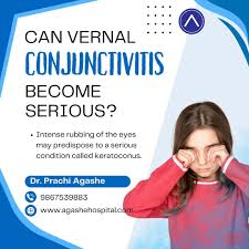 Image result for Vernal Conjunctivitis