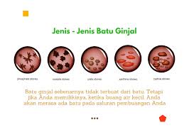 Batu karang adalah pembentukan batu di dalam saluran air kencing dan ia akan menyebabkan sakit belakang yang teruk dan pendarahan ketika isi kandungan. Batu Ginjal Penyebab Gejala Diagnosa Pencegahan