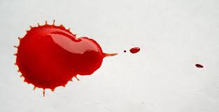 Haid adalah hal yang biasa dan normal terjadi pada wanita, namun jika warna darahnya bukanlah merah, maka inilah yang menjadi kekhawatiran. 9 Sebab Berlakunya Spotting Pendarahan Ketika Hamil