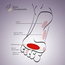 Metatarsalgia Develops When Something Changes Or Threatens The Normal Mechanics Of The Foot Ultimately This Cre How To Relieve Stress Chiropractic Feet Care