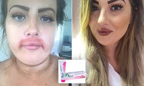 | there's no evidence that chemical hair removers pose any serious risk to you or your baby when you're pregnant. Mother Who Smothered Her Top Lip With 99p Hair Removal Cream Left With Chemical Burn Daily Mail Online