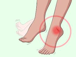 Tout Savoir Sur La Goutte Une Affection Du Pied Podformance