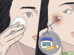 3 Easy Ways To Prevent Scarring On Your Face - Wikihow