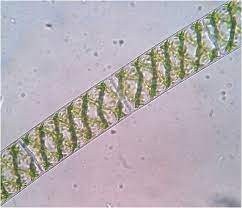 We did not find results for: Microscopic Photograph Of Spirogyra Sp 40x Download Scientific Diagram