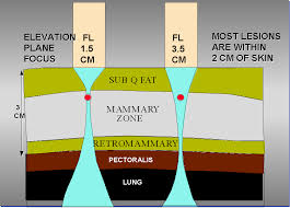 The breast is a modified sweat gland located in the superficial fascia of the anterior chest wall.the major portion of the breast tissue is situated between the second and third rib superiorly, the sixth and seventh costal cartilage inferiorly, the anterior axillary line laterally, and the sternal border medially. Sonography Of The Breast