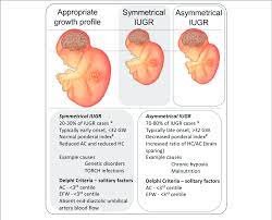 Representation Of The Physical Presentation Of Symmetrical And Download Scientific Diagram