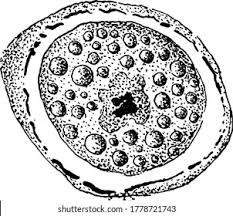 Image result for Cyclospora
