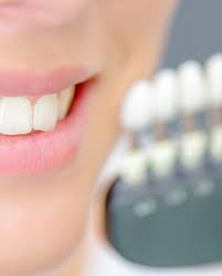 Trusted retailer of health & beauty products since 2001 Professional Teeth Whitening Yamanto