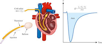 Image result for Blood Volume