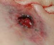 Hollow points or full metal jacket? Gunshot Wounds Are Your Stories Riddled With Hollow Points Lee Lofland