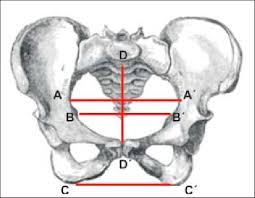 (or any other drive where system encryption is or was used) using the right mouse button and select turn on bitlocker: Pelvis Osea A A Diametro Transverso B B Diametro Biciatico C C Download Scientific Diagram