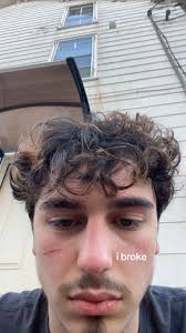 A Glow Stick Has to Break in Order to Glow