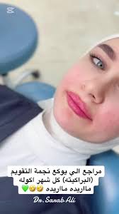 تقويم الأسنان: كل ما تحتاج معرفته عن الأنواع المختلفة