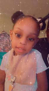 Our beautiful girl was born at 33 weeks with a tough start at life right  from the beginning life decided to make it even harder with giving her the  hand of having