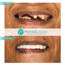 Od. Harold Solano (@odont.harolds) · Fonseca