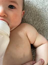 Hiya! I'm a first time mom, I'm 36+4 and my doc said my blood pressure was  a little high today and the baby is also breech, she is scheduling me a  C-section