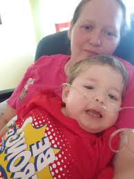 That is a urine collection bag attached to his leg. It collects the urine  draining from a catheter due to his bladder incontinence.