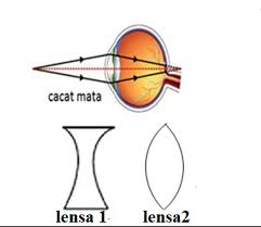 Fungsi dari kacamata adalah mengatur supaya bayangan benda yang tidak dapat dilihat dengan jelas oleh mata menjadi jatuh di titik dekat atau di titik jauh mata, bergantung pada jenis cacat matanya. Dari Gambar Di Atas Jenis Cacat Mata Dan Lensa Kacamata Yang Cocok Untuk Menolongnya Brainly Co Id