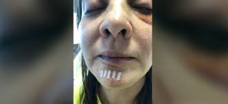 Solo un cobarde le hace esto a una mujer”, reitera hermano de Abril sobre  el caso que indignó a México