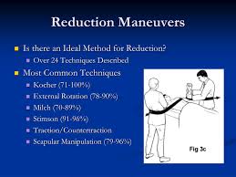 Image result for Shoulder Relocation Maneuvers
