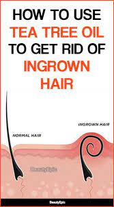 How Effective Is Using Tea Tree Oil For Ingrown Hair Ingrown Hair Hair Tea Tea Tree Oil Hair