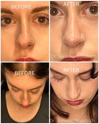 Jennifer Goodrich Md