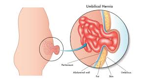 Image result for Umbilicus