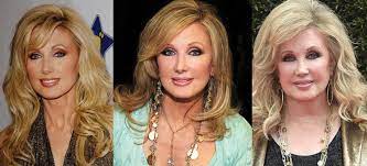 Click here to view morgan fairchild plastic surgery before and after botox photos, also read the reasons, results and surgeon claims about her morgan . Morgan Fairchild Plastic Surgery Before And After Pictures 2021