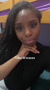 Braces Transition Guide: From Getting On to Removal