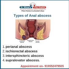 Image result for Intersphincteric Abscess