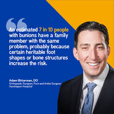 Bunions can be painful, making it difficult to wear shoes, walk and stay  active. It's important to treat bunions quickly as they can progress,  raising your risk of arthritis, bursitis, and other