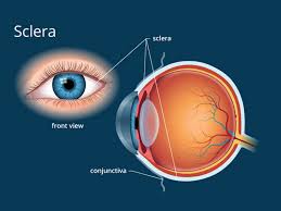 Image result for lesion sclera