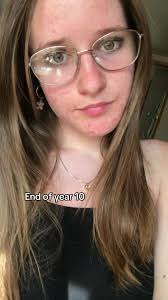 Year 10 Vs Now New Years