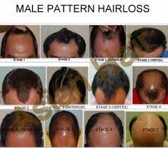 The power of these two hormones grouped together break down the hair growth cycle by making the anagen (growth) phase progressively shorter. Androgenic Alopecia Best Treatment Options Dr Julieta Arambulo