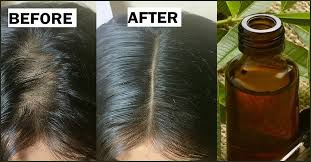Hair bleach contains a variety of chemicals, including ammonium persulfate, hydrogen, and stearyl alcohol. Tea Tree Oil For Lice How Does It Work