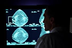 Your chances of being diagnosed with cancer after a callback are small, but your doctor wants to be sure there is no cancer present. Breast Cancer Signs Symptoms And Understanding An Imaging Report Saint John S Cancer Institute