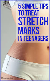 Pin On Beauty And Health