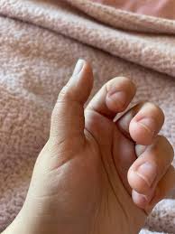 I have two students who are currently struggling with vibrato. One is a  young violist who has a short thumb that she can't relax out of locking the  base joint (photo of