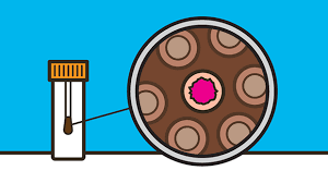 Colon these symptoms do not necessarily indicate that you have colon cancer. Detecting Cancer Early Looking For Cancer Clues In Poo Cancer Research Uk Cancer News